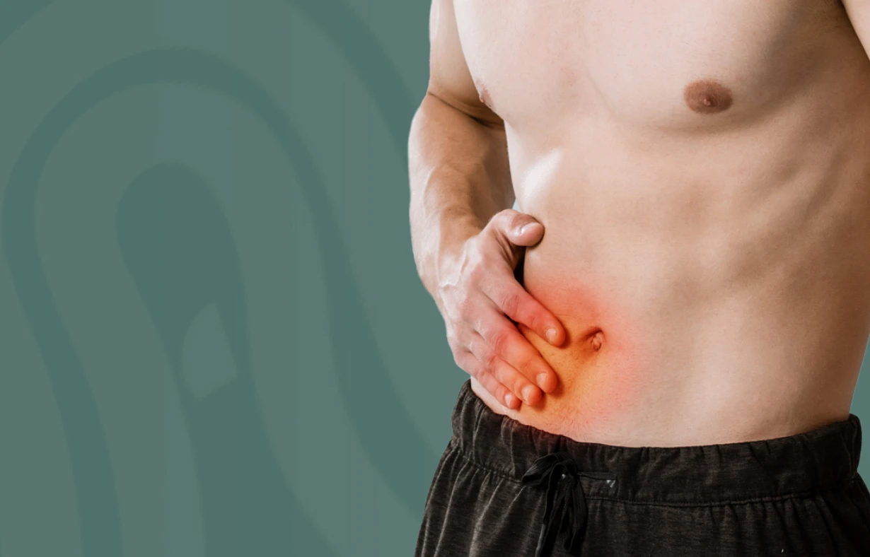 Hernias | Proctóloga Santo Domingo